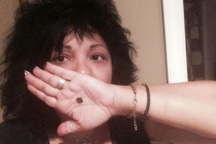 Illustration de l'article : Si une femme vous montre un point noir sur sa main, ne restez pas indiff&eacute;rent ! Ceci peut sauver des vies !