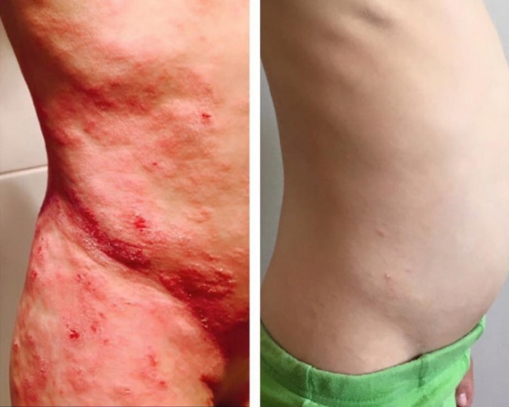 Illustration de l'article : Elle est oblig&eacute;e de filmer son fils parce que les m&eacute;decins ne la croient pas quand elle explique ce qu'il se passe avec son fils de 6 ans...