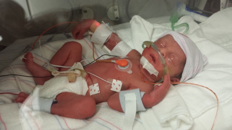 Illustration de l'article : La maman est d&eacute;c&eacute;d&eacute;e en accouchant de quadrupl&eacute;s, mais regardez bien la r&eacute;action du papa !