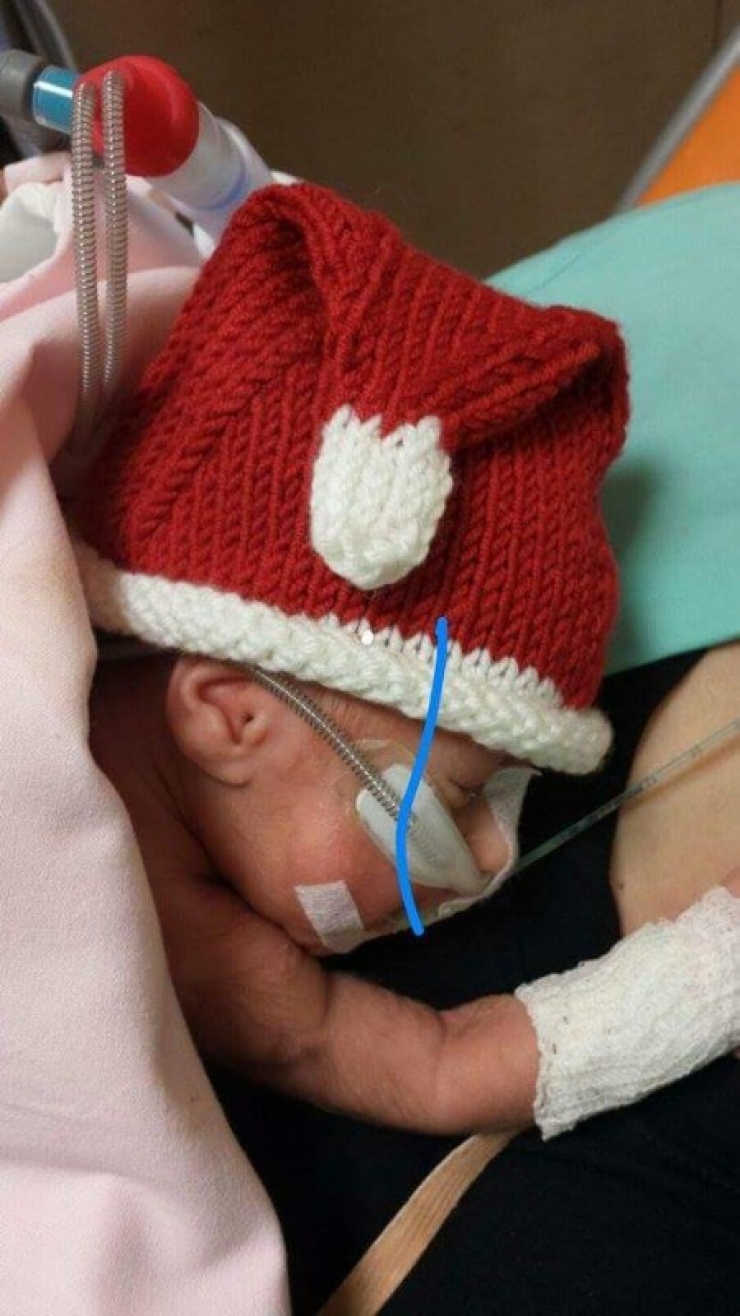 Illustration de l'article : Ce petit bout ne pèse que 450g, mais sa maman trouve ça dans son berceau juste après sa naissance...