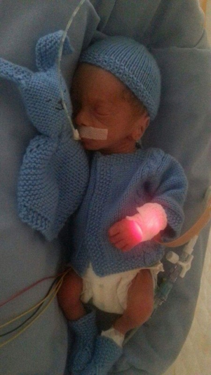 Illustration de l'article : Ce petit bout ne pèse que 450g, mais sa maman trouve ça dans son berceau juste après sa naissance...