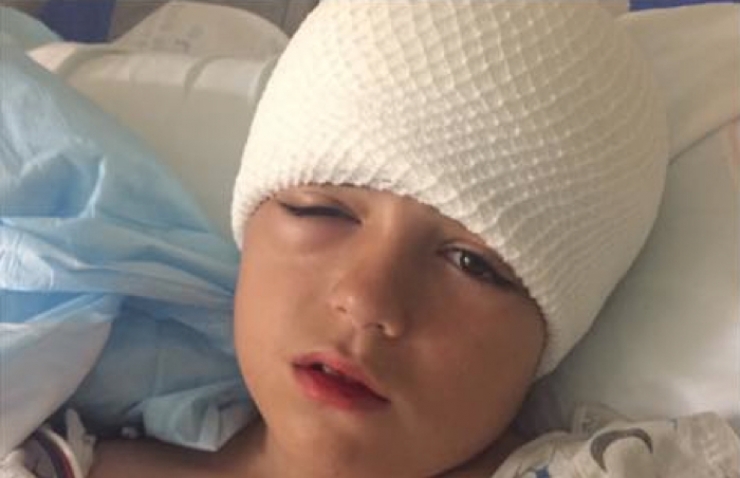 Illustration de l'article : Elle trouve que son fils agit bizarrement apr&egrave;s avoir jou&eacute; dehors. Deux jours plus tard, elle d&eacute;couvre ceci sur sa t&ecirc;te: 