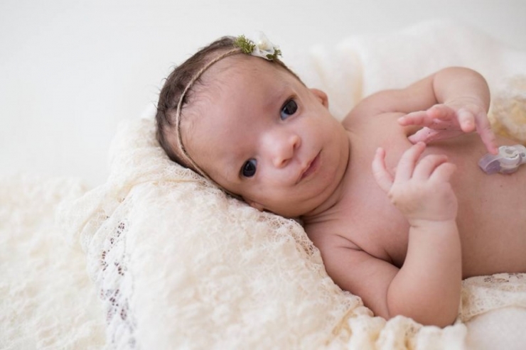 Illustration de l'article : Elle voulait faire adopter son bébé mais en voyant son visage, ce qu'elle a fait est magnifique !