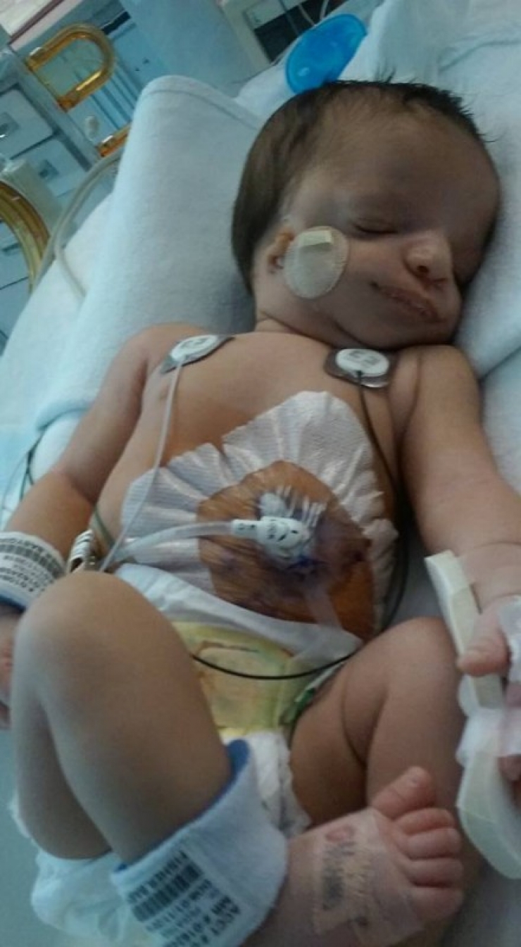 Illustration de l'article : Elle voulait faire adopter son bébé mais en voyant son visage, ce qu'elle a fait est magnifique !