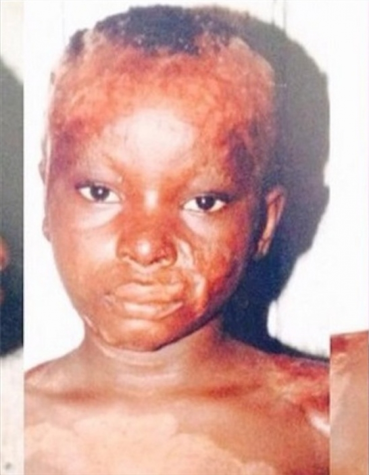 Illustration de l'article : Elle masque une partie de son visage avec la main. Vous risquez d'être stupéfait quand elle la retire !