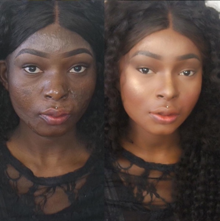 Illustration de l'article : Elle masque une partie de son visage avec la main. Vous risquez d'être stupéfait quand elle la retire !