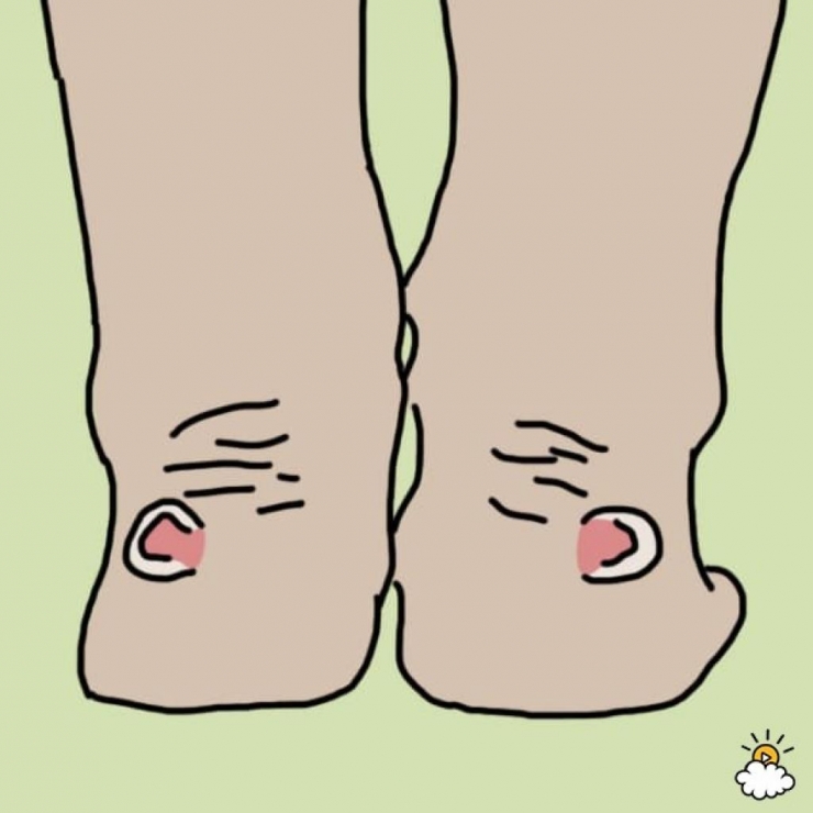 Illustration de l'article : Cette femme met ses pieds dans du Listerine, regardez bien le résultat après 30 minutes !