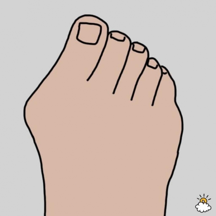 Illustration de l'article : Cette femme met ses pieds dans du Listerine, regardez bien le résultat après 30 minutes !