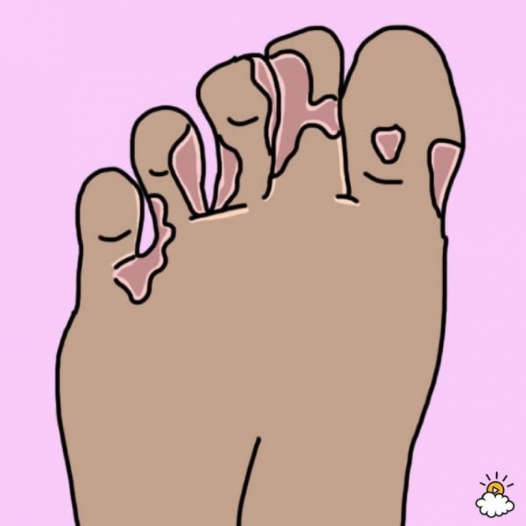 Illustration de l'article : Cette femme met ses pieds dans du Listerine, regardez bien le résultat après 30 minutes !