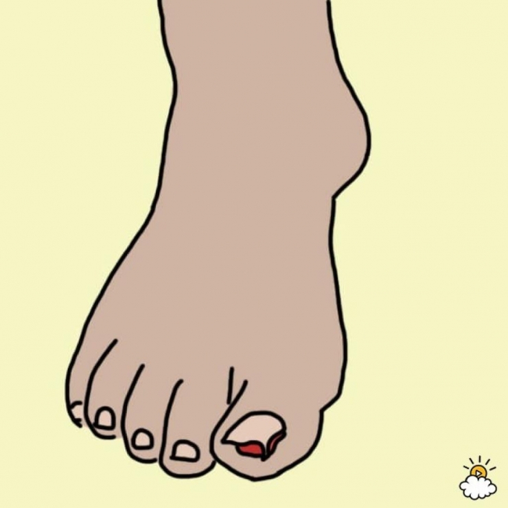 Illustration de l'article : Cette femme met ses pieds dans du Listerine, regardez bien le résultat après 30 minutes !