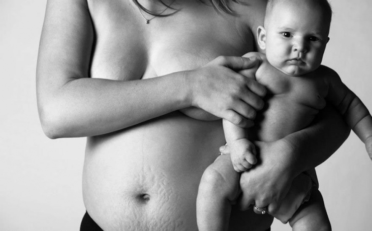 Illustration de l'article : Des clich&eacute;s qui montrent la r&eacute;alit&eacute; du corps apr&egrave;s l'accouchement. La beaut&eacute; sans artifices...