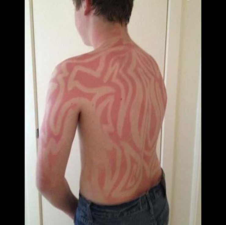 Illustration de l'article : Ces 22 personnes auraient dû suivre des cours avant de vouloir bronzer...