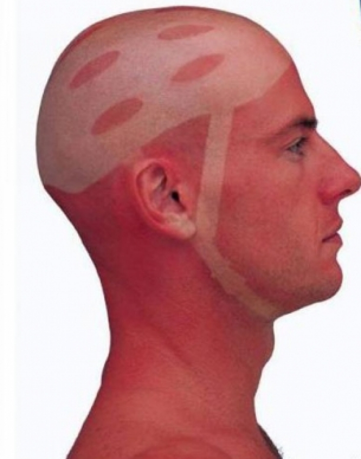 Illustration de l'article : Ces 22 personnes auraient dû suivre des cours avant de vouloir bronzer...