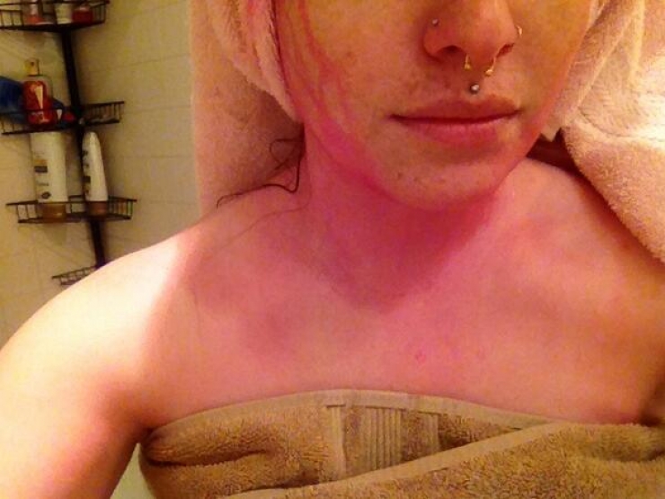 Illustration de l'article : Vous connaissiez ces 18 astuces &agrave; faire avec du dentifrice ? Sympa le truc des piq&ucirc;res...