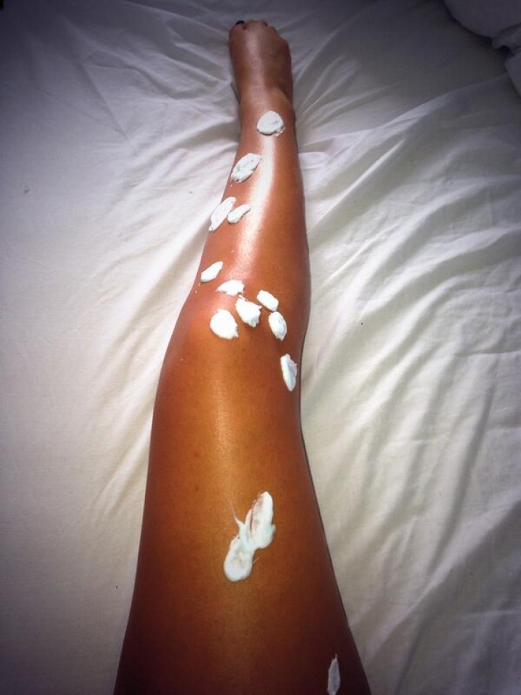 Illustration de l'article : Vous connaissiez ces 18 astuces &agrave; faire avec du dentifrice ? Sympa le truc des piq&ucirc;res...