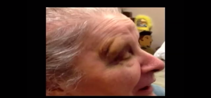 Illustration de l'article : Cette aide soignante ignore qu'on la filme alors qu'elle est occup&eacute;e &agrave; coller une couche sale sur le visage d'une patiente !