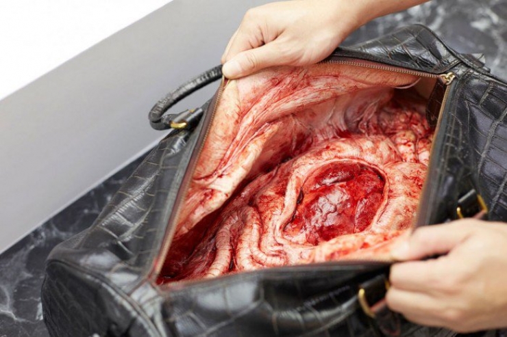 Illustration de l'article : N'achetez plus ce genre de sacs de luxe, vous ne pouvez plus nier la vérité qui se cache derrière ! C'est Horrible...
