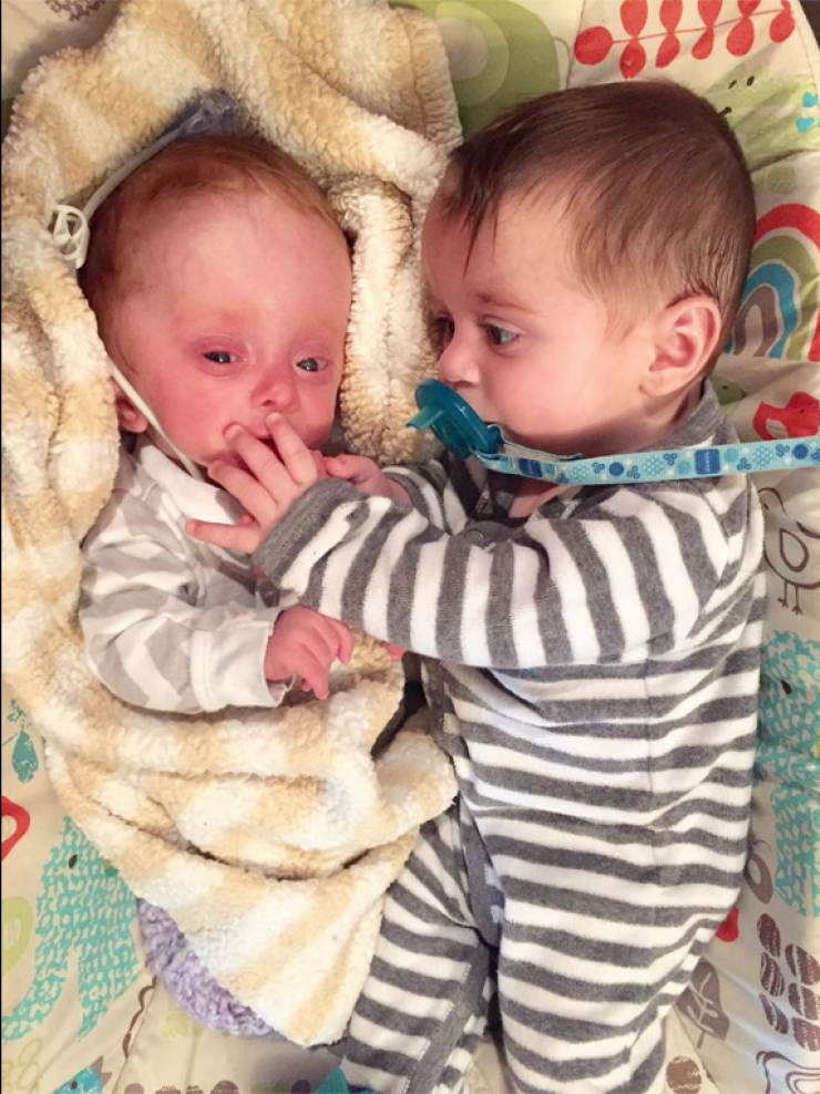 Illustration de l'article : Ce bébé né sans cerveau aurait été abandonné par sa mère sans l’arrivée de ce couple...