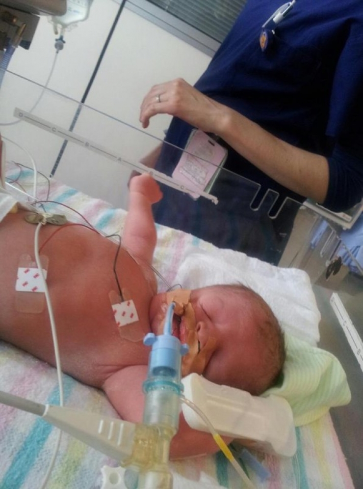 Illustration de l'article : Il est all&eacute; en Australie pour voir un petit gar&ccedil;on au visage d&eacute;form&eacute;... Il nous fait passer un message rempli d'espoir !