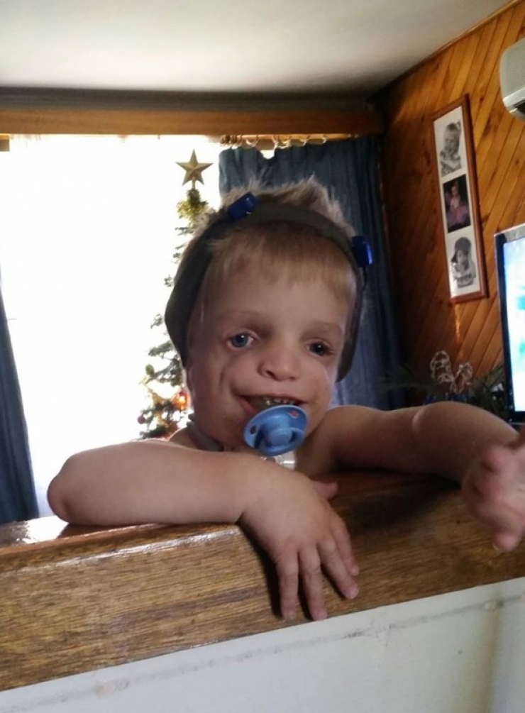 Illustration de l'article : Il est all&eacute; en Australie pour voir un petit gar&ccedil;on au visage d&eacute;form&eacute;... Il nous fait passer un message rempli d'espoir !