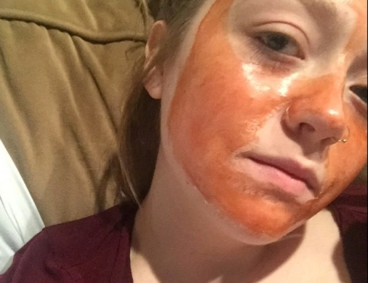 Illustration de l'article : Les bienfaits d'une tomate plac&eacute;e sur votre peau pendant une heure... Une excellente astuce !