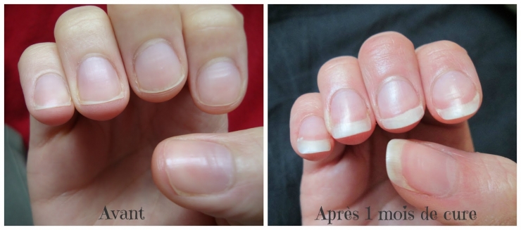 Illustration de l'article : L'huile de ricin n'est pas uniquement utilis&eacute;e comme laxatif... Voici ce qu'elle apporte aux cheveux et aux sourcils !