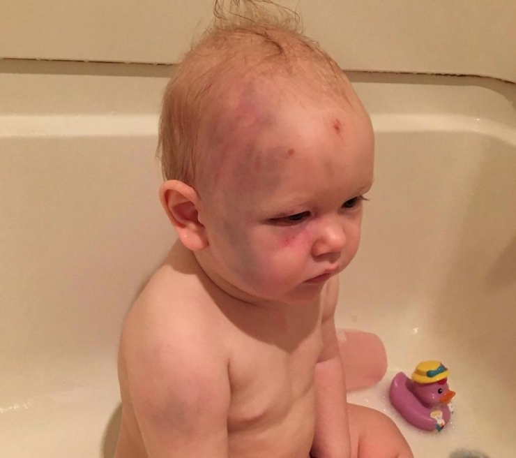 Illustration de l'article : Ils sortent du restaurant et trouvent leur fils dans cet &eacute;tat en rentrant ! Quel choc, faites attention &agrave; ceci: 