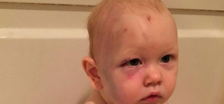 Illustration de l'article : Ils sortent du restaurant et trouvent leur fils dans cet &eacute;tat en rentrant ! Quel choc, faites attention &agrave; ceci: 