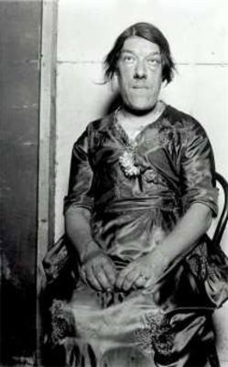 La Femme La Plus Laide Du Monde Mary Ann Communauté MCMS