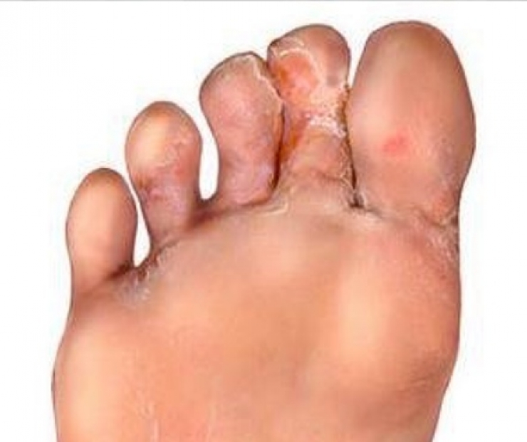 Illustration de l'article : M&ecirc;me si vous trouvez &ccedil;a r&eacute;pugnant, vous devez faire pipi dans votre douche ! Voici pourquoi :