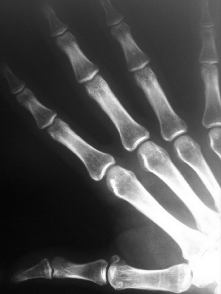 Illustration de l'article : 7 bénéfices santé qui vous donneront envie de boire une bonne bière plus souvent...