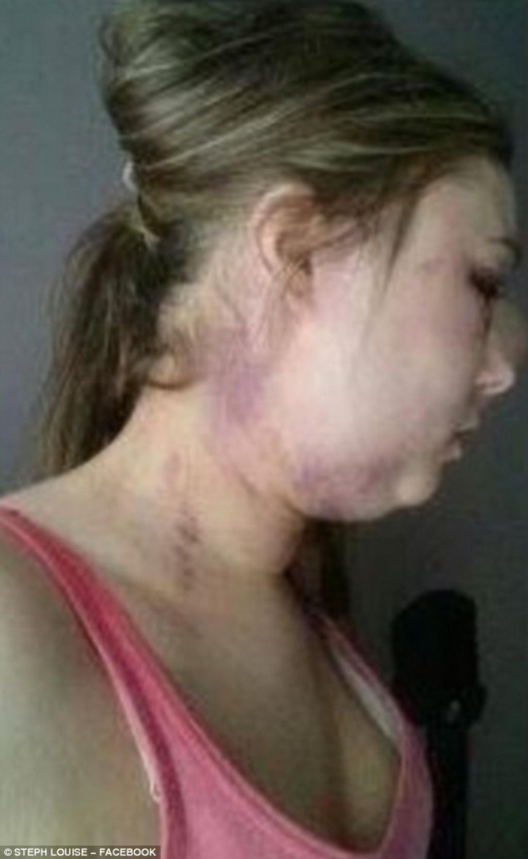 Illustration de l'article : Parce qu'elle refuse de faire l'amour avec son mec, ce qu'il lui fait est r&eacute;pugnant !