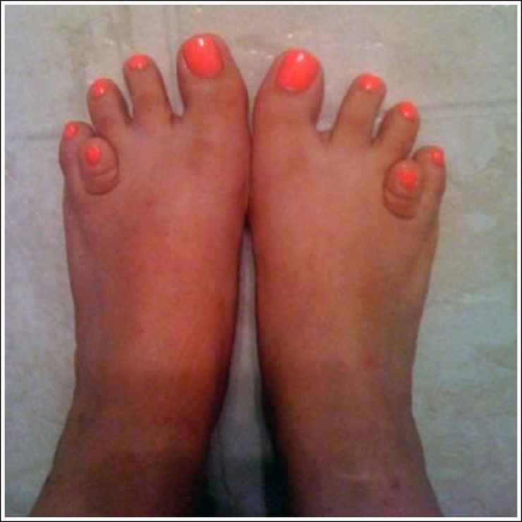 Les Pieds Les Plus Moches Du Monde Top 19 des plus moches photos de pieds... De quoi décomplexer