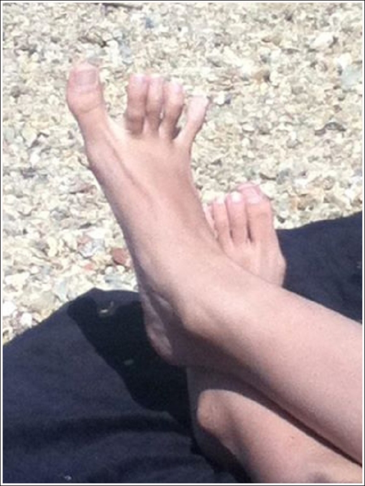 Illustration de l'article : Top 19 des plus moches photos de pieds... De quoi d&eacute;complexer !