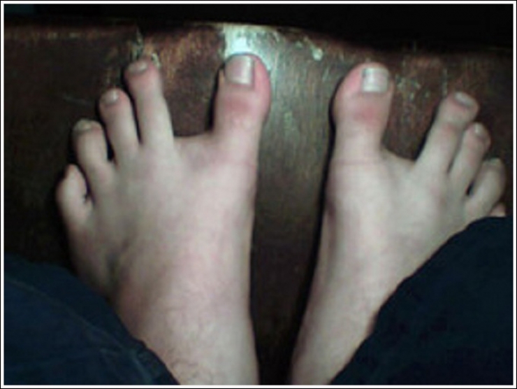 Illustration de l'article : Top 19 des plus moches photos de pieds... De quoi d&eacute;complexer !