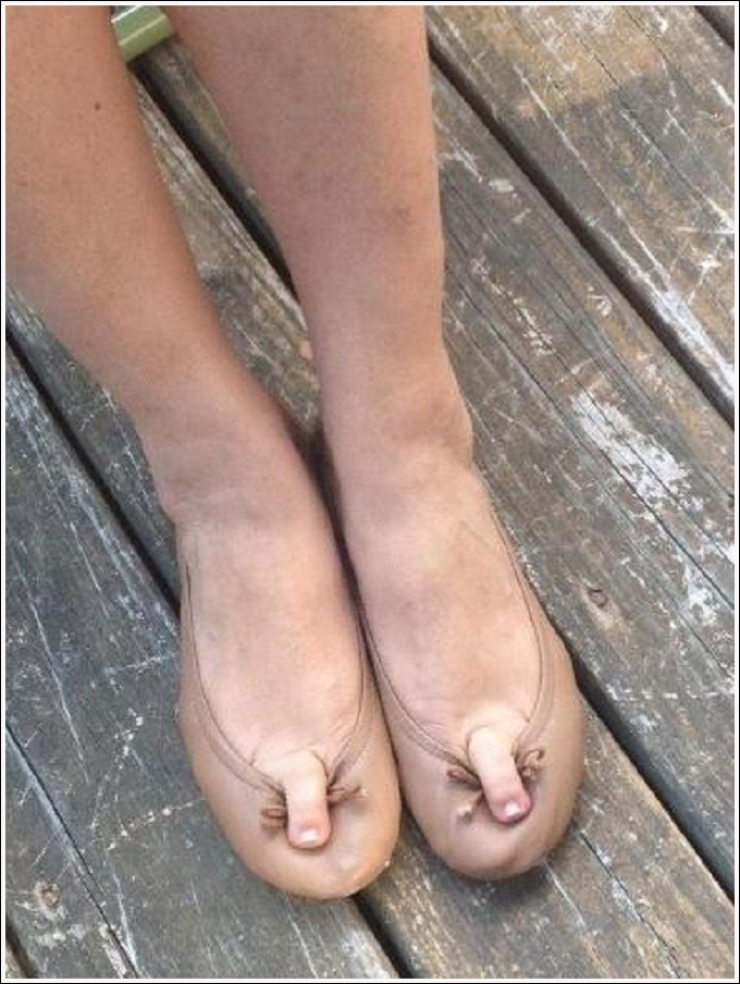 Top 19 Des Plus Moches Photos De Pieds De Quoi Decomplexer