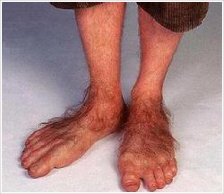 Illustration de l'article : Top 19 des plus moches photos de pieds... De quoi d&eacute;complexer !