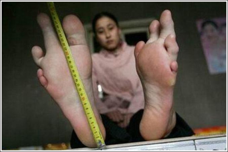 Top 19 Des Plus Moches Photos De Pieds De Quoi Decomplexer