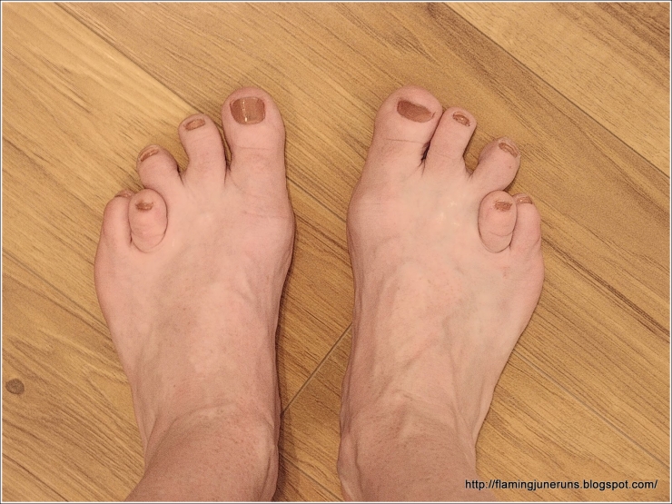 Top 19 Des Plus Moches Photos De Pieds De Quoi Decomplexer