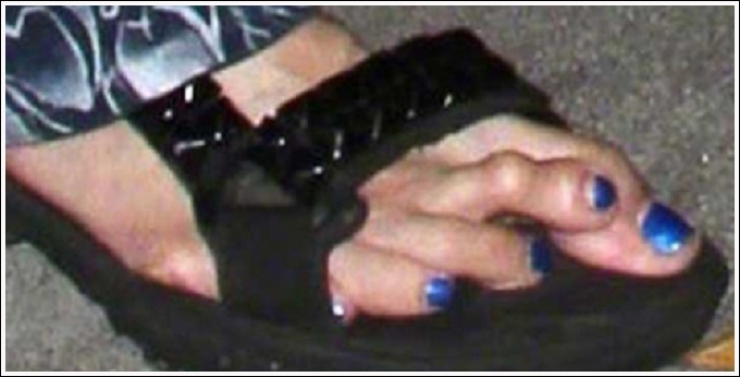 Illustration de l'article : Top 19 des plus moches photos de pieds... De quoi d&eacute;complexer !