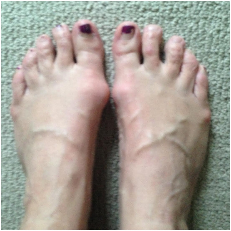 Illustration de l'article : Top 19 des plus moches photos de pieds... De quoi d&eacute;complexer !