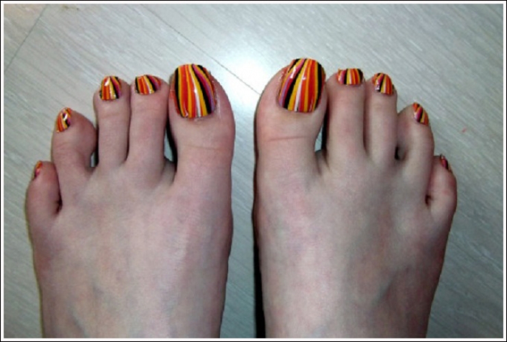 Illustration de l'article : Top 19 des plus moches photos de pieds... De quoi d&eacute;complexer !