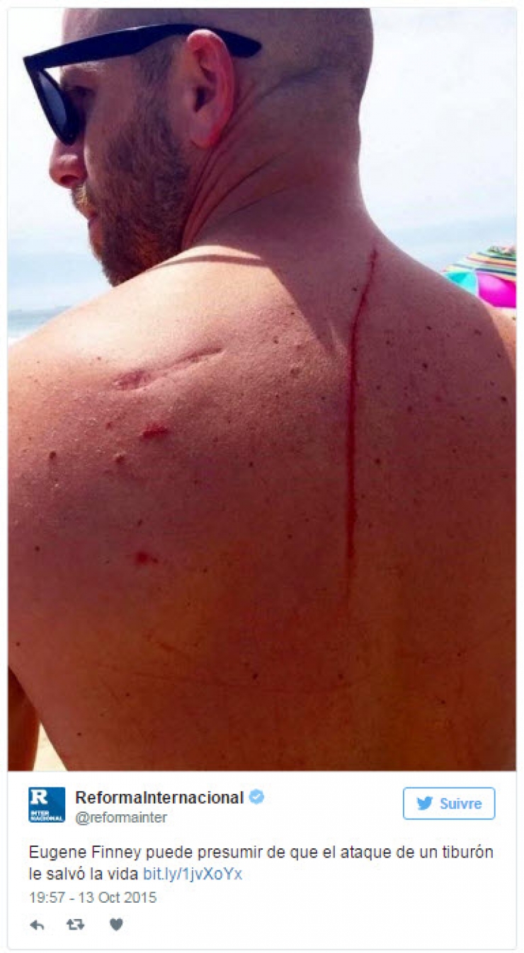 Illustration de l'article : C'est bien la premi&egrave;re fois qu'une attaque de requin permet de sauver une vie !