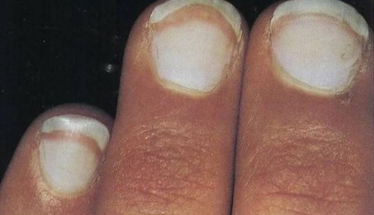 Nail art Bijoux noir et blanc - L'îlot Nailart | Vernis à ongles noir,  Ongles, Ongle noir et blanc