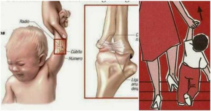 Illustration de l'article : Vous ne devez JAMAIS tirer le bras de votre enfant ! On vous explique pourquoi:
