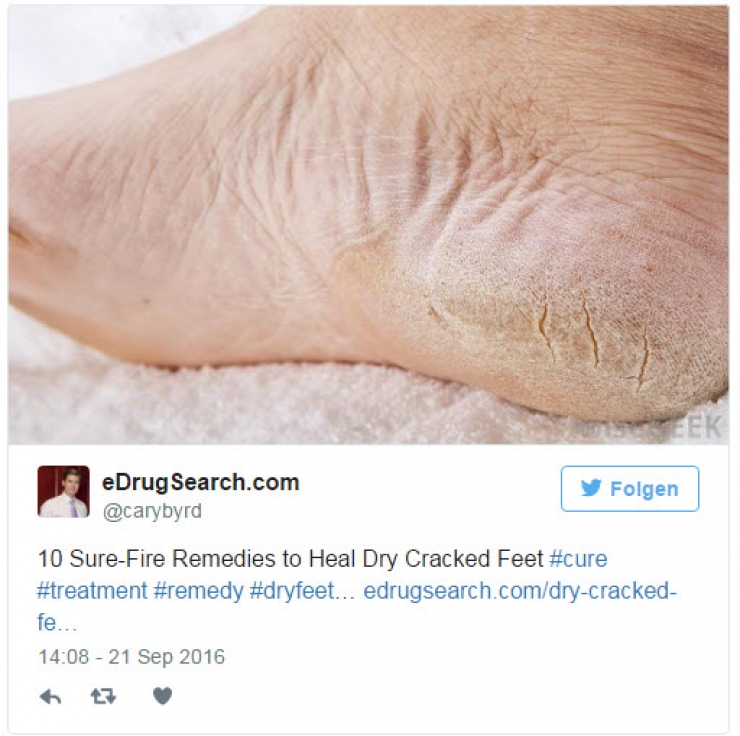 Illustration de l'article : Avant de vous ruiner dans des pédicures, utilisez cette astuce ! Deux ingrédients pour retrouver des pieds de bébé !