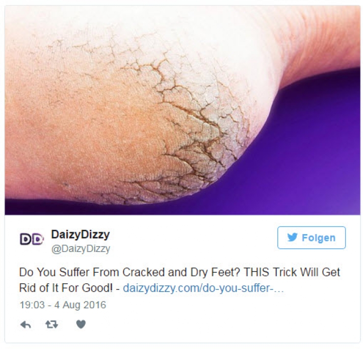 Illustration de l'article : Avant de vous ruiner dans des pédicures, utilisez cette astuce ! Deux ingrédients pour retrouver des pieds de bébé !