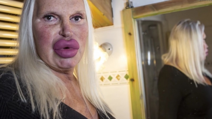 Illustration de l'article : Pour obtenir un look "parfait", cette "femme" a dépensé plus de 75.000 Euros... Qu'en pensez-vous face aux photos d'avant ?