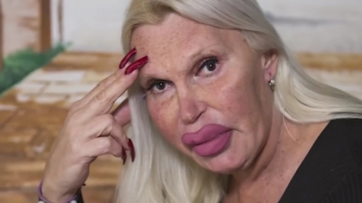 Illustration de l'article : Pour obtenir un look "parfait", cette "femme" a dépensé plus de 75.000 Euros... Qu'en pensez-vous face aux photos d'avant ?