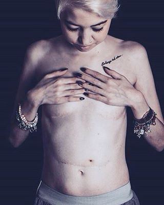 Illustration de l'article : On lui retire l'intestin à 16 ans, aujourd'hui les photos de son corps et de son projet touchent tout le monde!